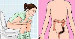 What Are the Symptoms of Bad Constipation? A Clinical Deep Dive With a Gut-Friendly Solution