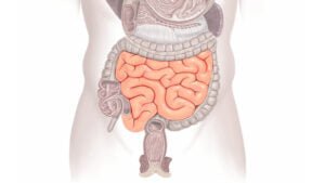 Gut Inflammation: Understanding, Managing - IV Nutrition