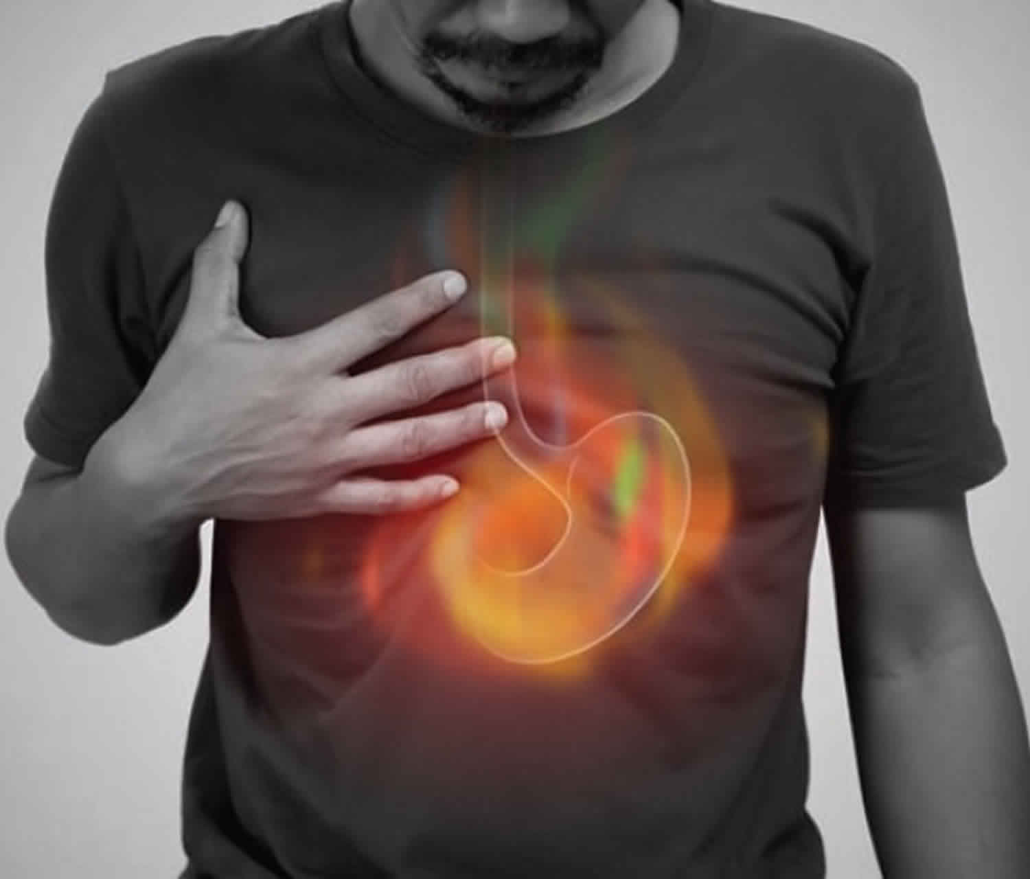 Preventing Gut Health Issues - IV Nutrition